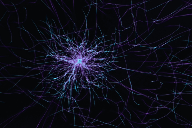 Motor Neurone Disease 