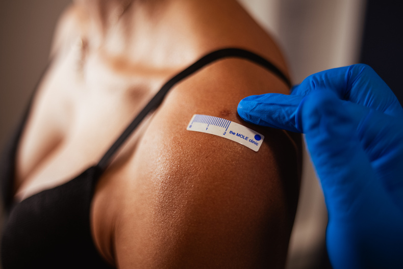 Mole Clinic - Sticker - Female.jpg
