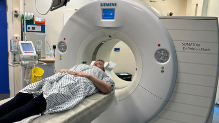 stroke AI CT scan.jpg