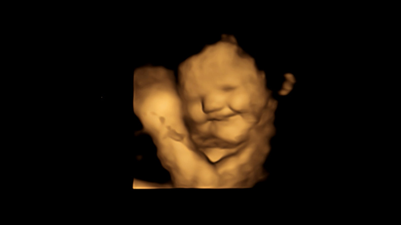 laughter-face-reaction-scan-image(899673)